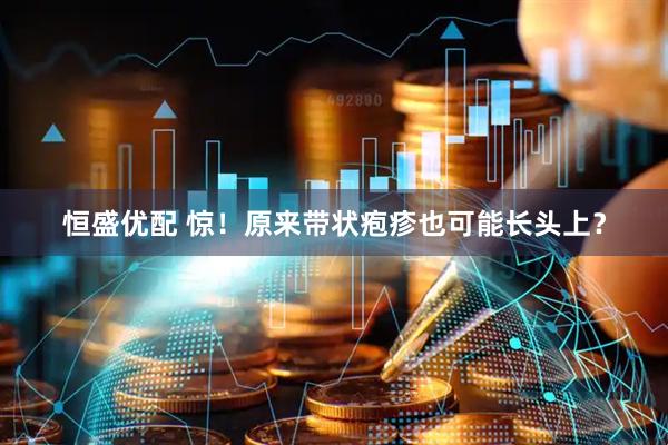 恒盛优配 惊！原来带状疱疹也可能长头上？